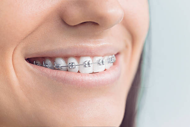 Best Dentures (Full and Partial)  in Indiantown, FL